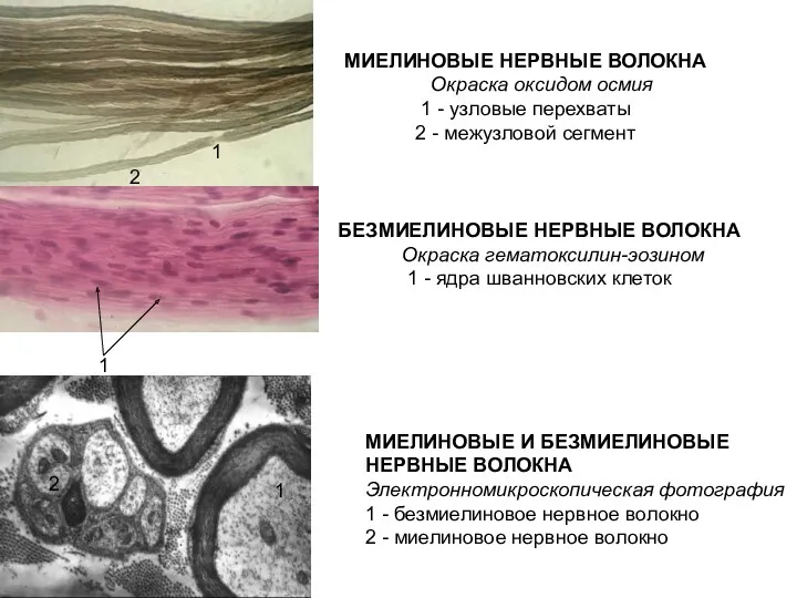 МИЕЛИНОВЫЕ НЕРВНЫЕ ВОЛОКНА Окраска оксидом осмия 1 - узловые перехваты