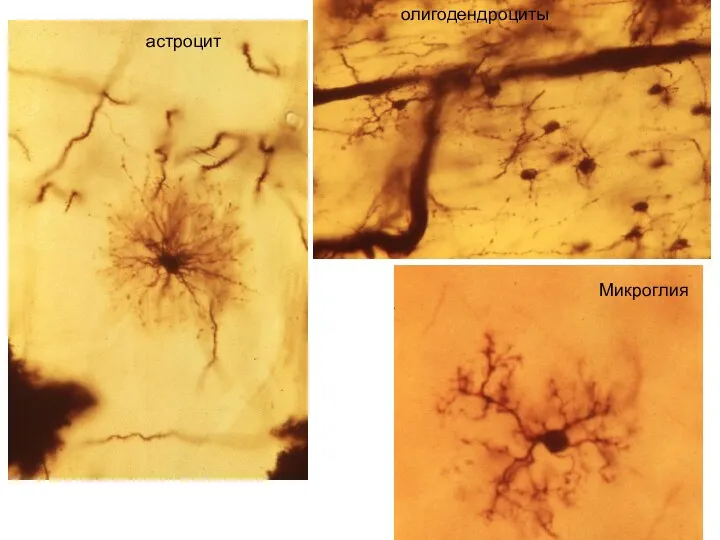 астроцит олигодендроциты Микроглия