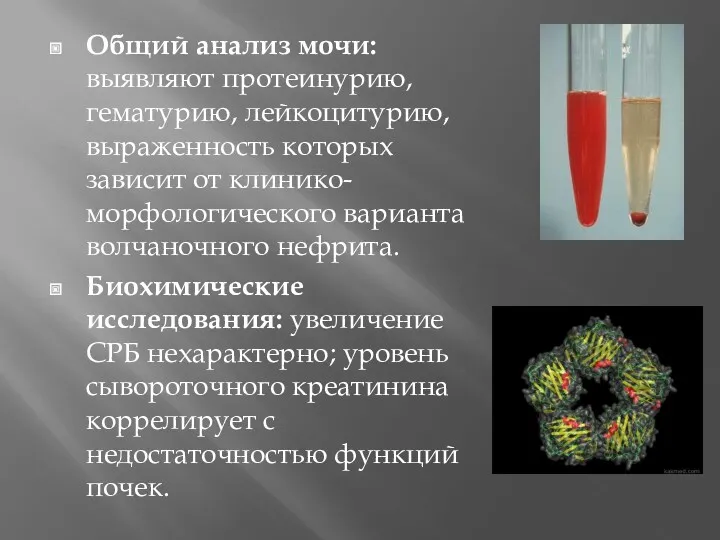 Общий анализ мочи: выявляют протеинурию, гематурию, лейкоцитурию, выраженность которых зависит