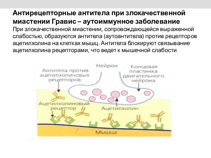 Антирецепторные антитела при злокачественной миастении Гравис – аутоиммунное заболевание При злокачественной миастении, сопровождающейся