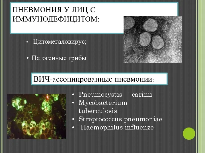 ПНЕВМОНИЯ У ЛИЦ С ИММУНОДЕФИЦИТОМ: Цитомегаловирус; Патогенные грибы ВИЧ-ассоциированные пневмонии: