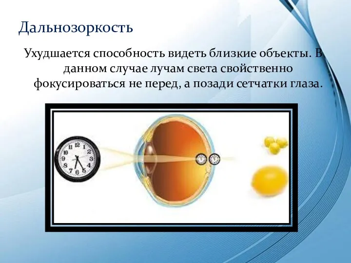 Ухудшается способность видеть близкие объекты. В данном случае лучам света