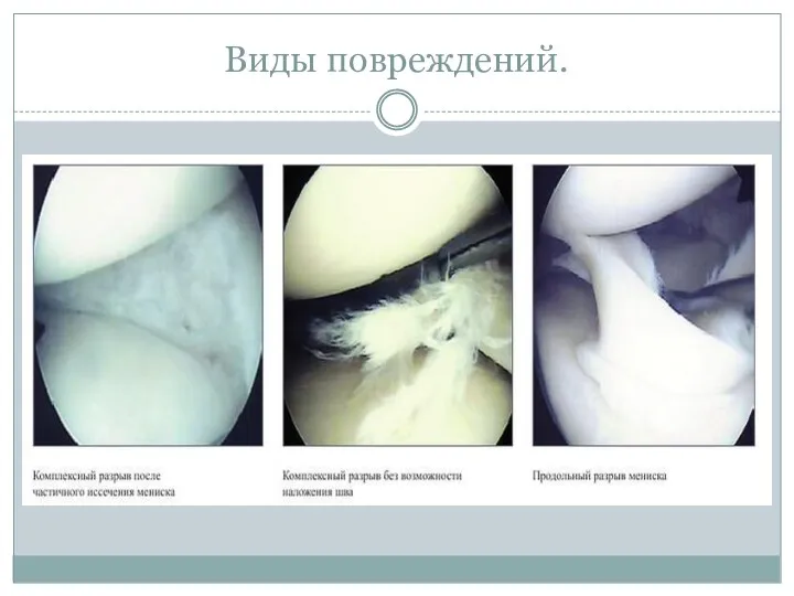 Виды повреждений.