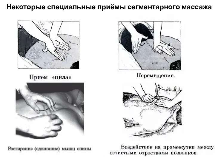 Некоторые специальные приёмы сегментарного массажа