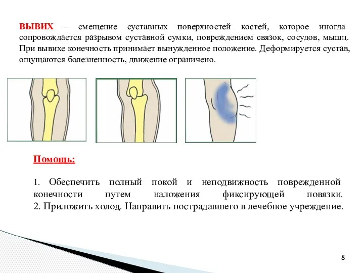 ВЫВИХ – смещение суставных поверхностей костей, которое иногда сопровождается разрывом