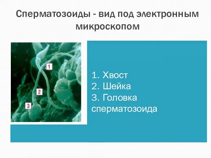 Сперматозоиды - вид под электронным микроскопом 1. Хвост 2. Шейка 3. Головка сперматозоида