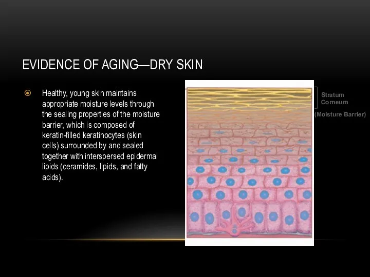 EVIDENCE OF AGING—DRY SKIN Healthy, young skin maintains appropriate moisture