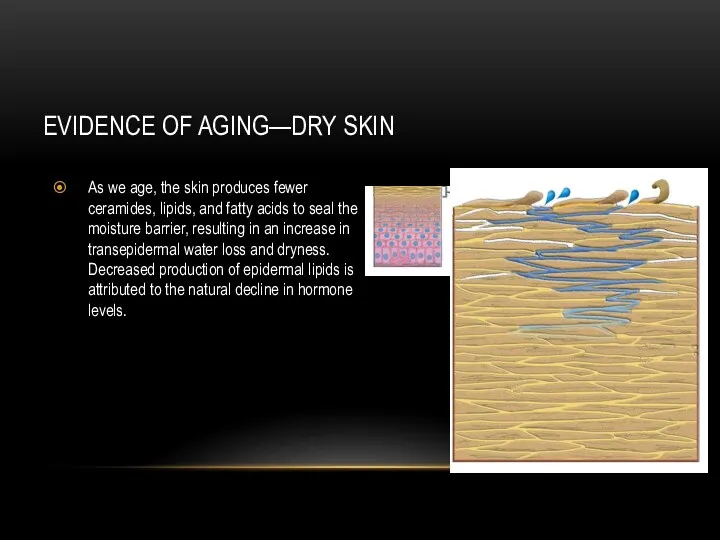 EVIDENCE OF AGING—DRY SKIN As we age, the skin produces