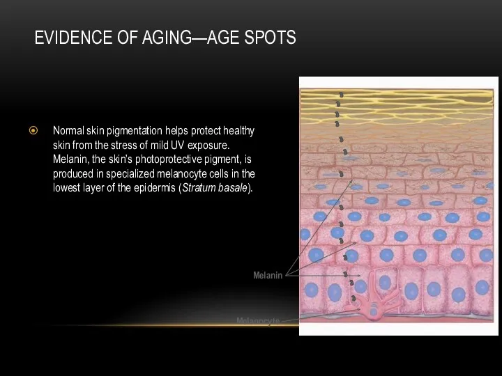 EVIDENCE OF AGING—AGE SPOTS Normal skin pigmentation helps protect healthy