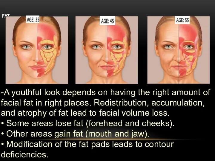 FAT -A youthful look depends on having the right amount of facial fat