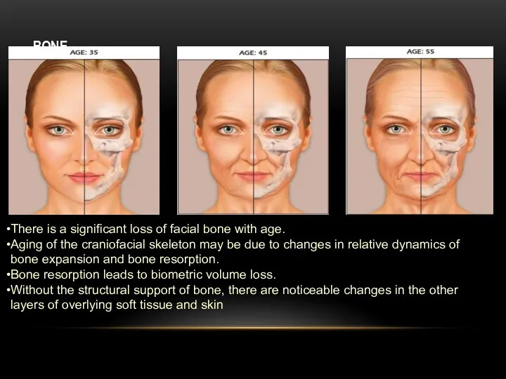 BONE There is a significant loss of facial bone with age. Aging of
