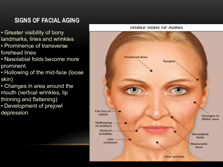 SIGNS OF FACIAL AGING • Greater visibility of bony landmarks, lines and wrinkles