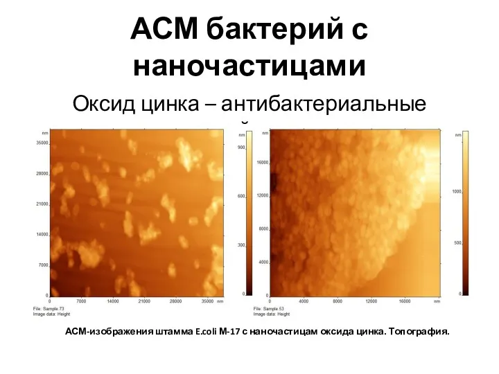 АСМ бактерий с наночастицами Оксид цинка – антибактериальные свойства АСМ-изображения штамма E.coli М-17