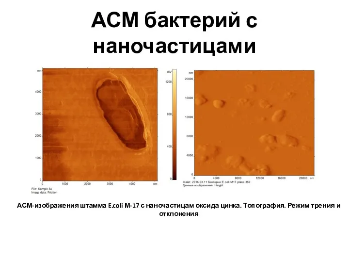 АСМ бактерий с наночастицами АСМ-изображения штамма E.coli М-17 с наночастицам оксида цинка. Топография.