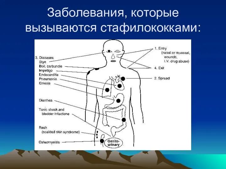 Заболевания, которые вызываются стафилококками: