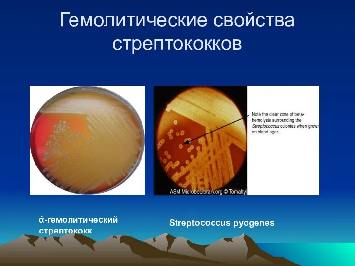 Гемолитические свойства стрептококков ά-гемолитический стрептококк Streptococcus pyogenes