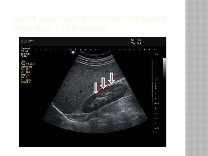 КАКОЕ АНАТОМИЧЕСКОЕ ОБРАЗОВАНИЕ ОТМЕЧЕНО СТРЕЛКАМИ?