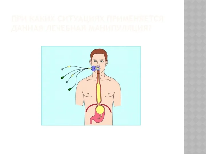 ПРИ КАКИХ СИТУАЦИЯХ ПРИМЕНЯЕТСЯ ДАННАЯ ЛЕЧЕБНАЯ МАНИПУЛЯЦИЯ?