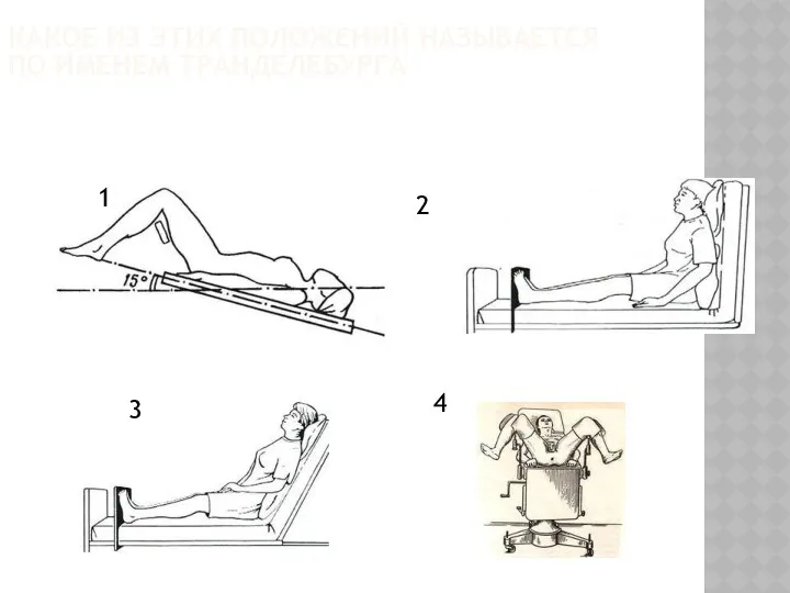 4 КАКОЕ ИЗ ЭТИХ ПОЛОЖЕНИЙ НАЗЫВАЕТСЯ ПО ИМЕНЕМ ТРАНДЕЛЕБУРГА 2 3 1