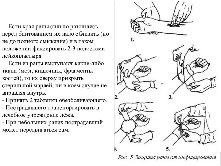 Если края раны сильно разошлись, перед бинтованием их надо сблизить