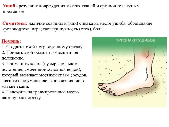 Ушиб - результат повреждения мягких тканей и органов тела тупым