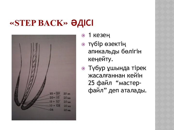 «STEP BACK» ӘДІСІ 1 кезең түбір өзектің апикальды бөлігін кеңейту.