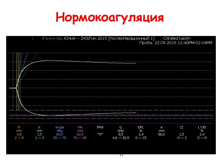 Нормокоагуляция ххххххххххххххххххх