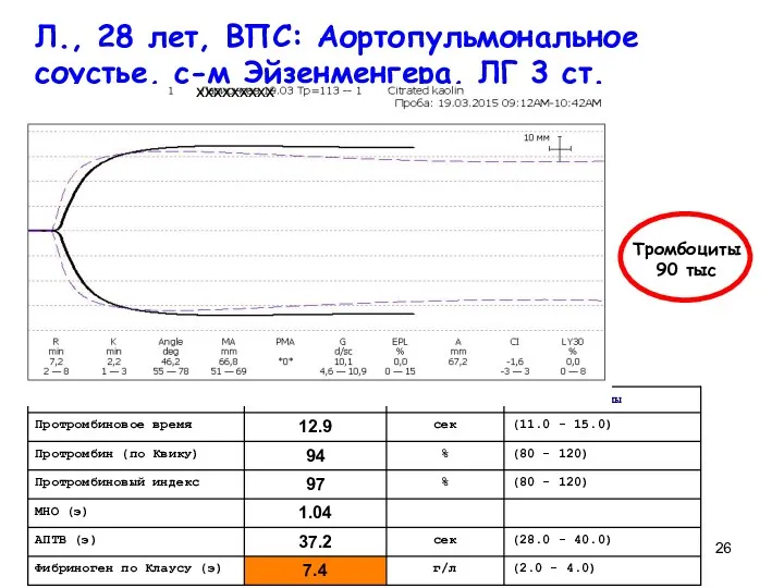 Л., 28 лет, ВПС: Аортопульмональное соустье, с-м Эйзенменгера, ЛГ 3 ст. Тромбоциты 90 тыс ххххххххх