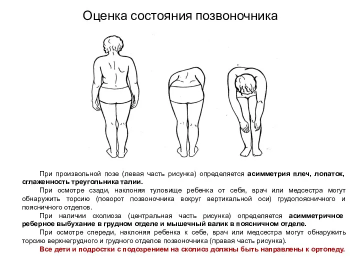 Оценка состояния позвоночника При произвольной позе (левая часть рисунка) определяется