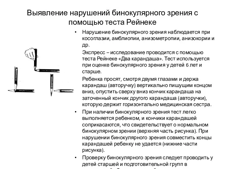 Выявление нарушений бинокулярного зрения с помощью теста Рейнеке Нарушение бинокулярного