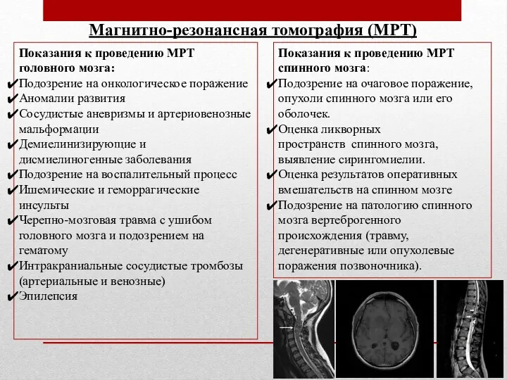 Магнитно-резонансная томография (МРТ) Показания к проведению МРТ головного мозга: Подозрение