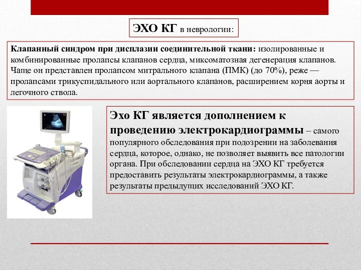 ЭХО КГ в неврологии: Клапанный синдром при дисплазии соединительной ткани: