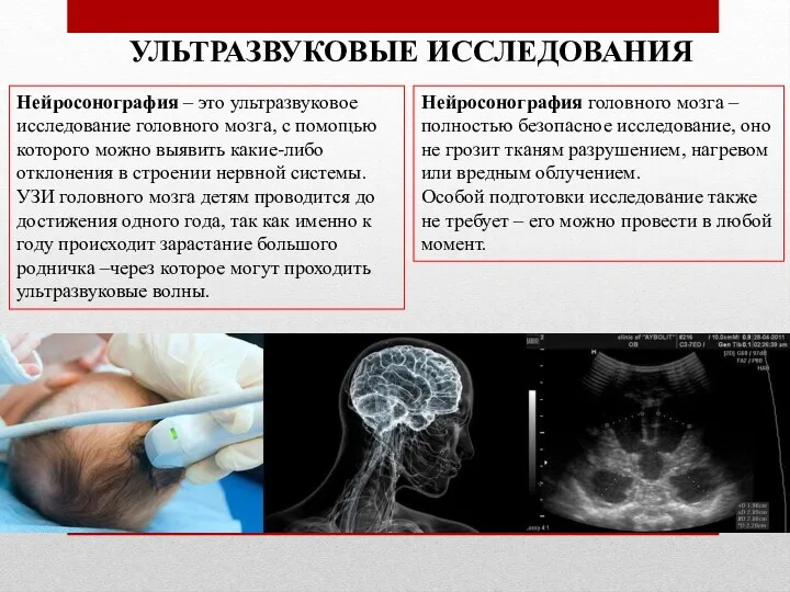 Нейросонография – это ультразвуковое исследование головного мозга, с помощью которого