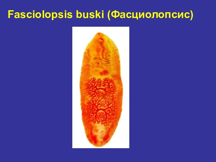 Fasciolopsis buski (Фасциолопсис)