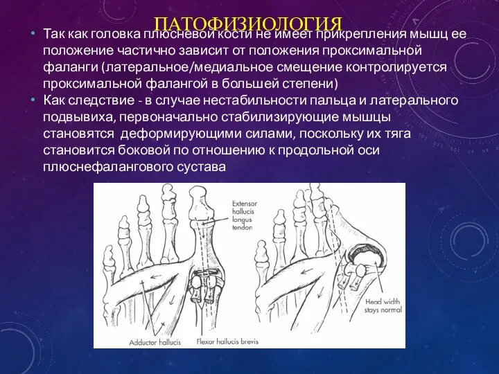 ПАТОФИЗИОЛОГИЯ Так как головка плюсневой кости не имеет прикрепления мышц