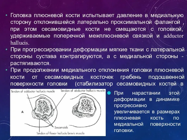 Головка плюсневой кости испытывает давление в медиальную сторону отклонившейся латерально