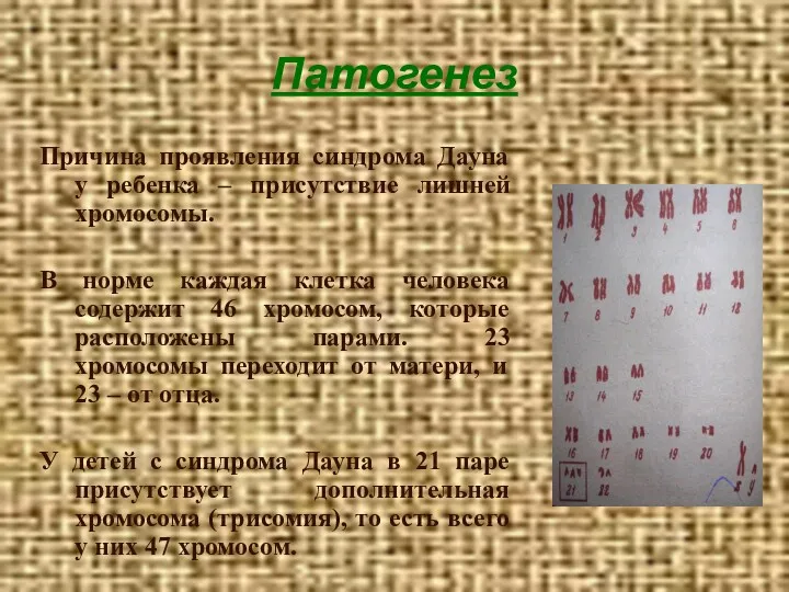 Патогенез Причина проявления синдрома Дауна у ребенка – присутствие лишней