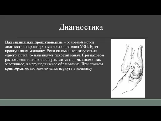 Диагностика Пальпация или прощупывание – основной метод диагностики крипторхизма до