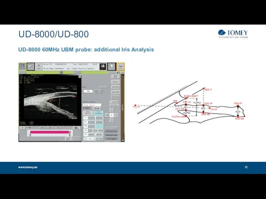 UD-8000/UD-800 www.tomey.de UD-8000 60MHz UBM probe: additional Iris Analysis