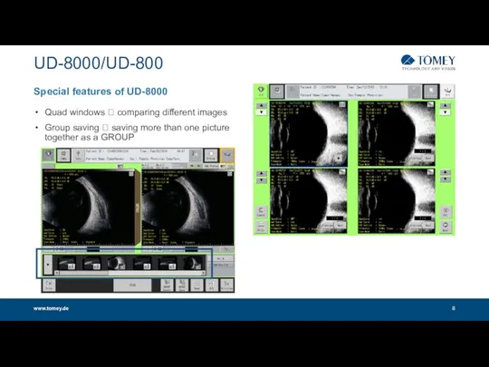 UD-8000/UD-800 www.tomey.de Special features of UD-8000 Quad windows ? comparing