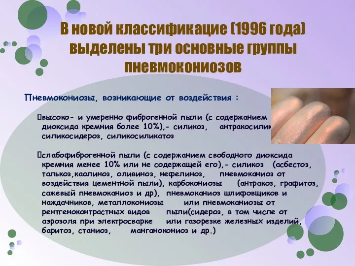 В новой классификацие (1996 года) выделены три основные группы пневмокониозов