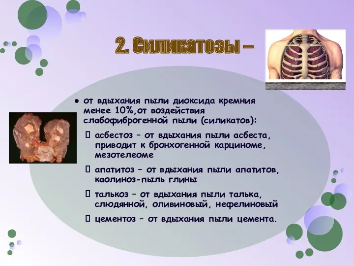 2. Силикатозы – от вдыхания пыли диоксида кремния менее 10%,от