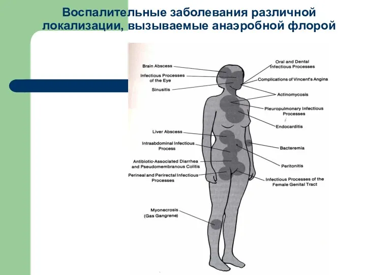 Воспалительные заболевания различной локализации, вызываемые анаэробной флорой