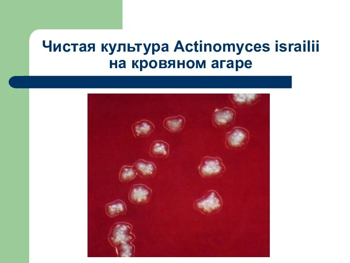 Чистая культура Actinomyces israilii на кровяном агаре