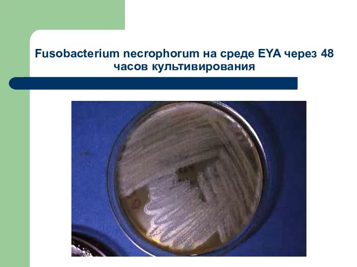 Fusobacterium necrophorum на среде EYA через 48 часов культивирования