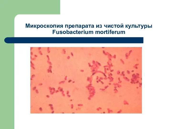 Микроскопия препарата из чистой культуры Fusobacterium mortiferum