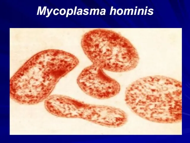 Mycoplasma hominis