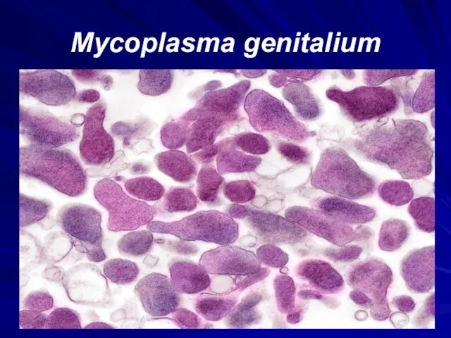 Mycoplasma genitalium