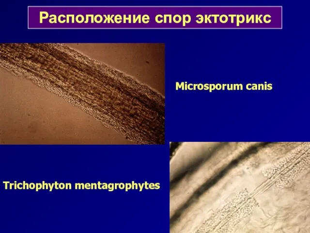 Расположение спор эктотрикс Microsporum canis Trichophyton mentagrophytes