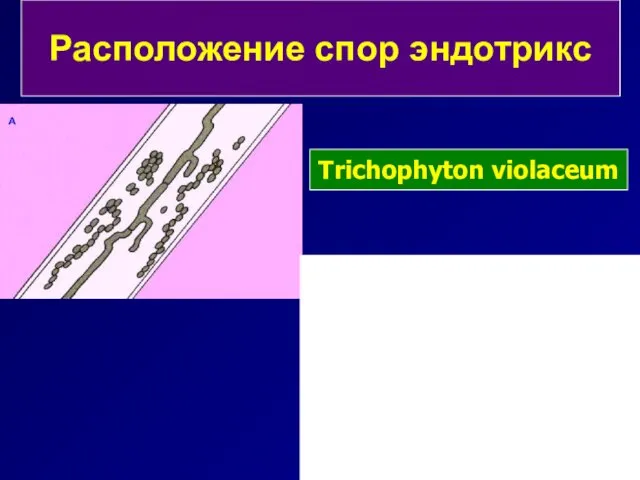 Расположение спор эндотрикс Trichophyton violaceum